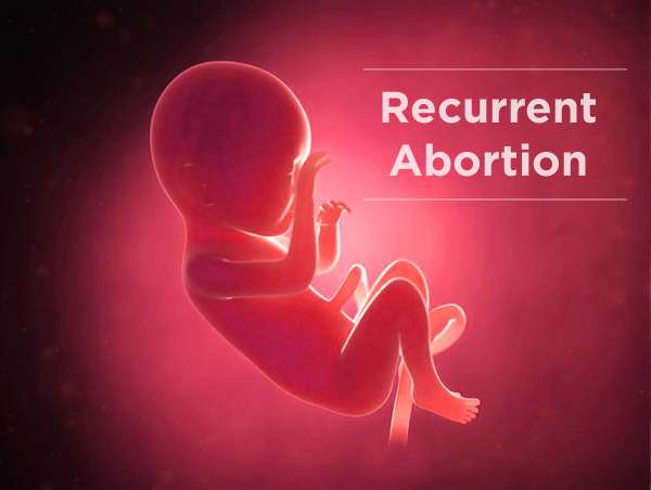 20180202-recurrent-abortion