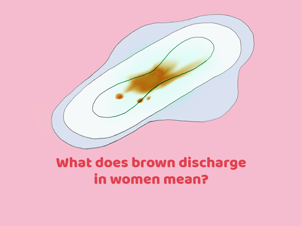 Brown discharge ?