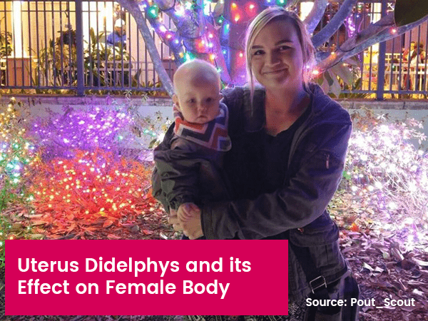 uterus-didelphys-and-its-effect-on-female-body