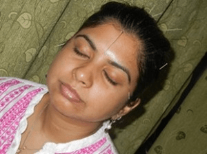 atraeyee-niharchandra_acupuncture_oowomaniya