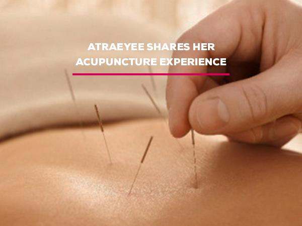 atraeyee-shares-her-acupuncture-experience