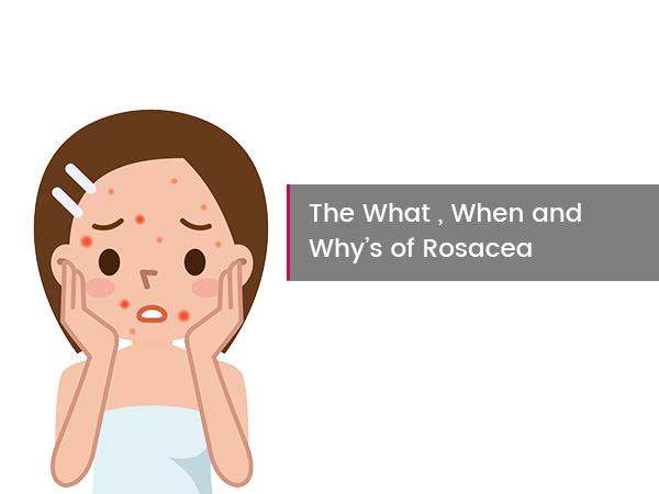 the-what-when-and-why-of-rosacea